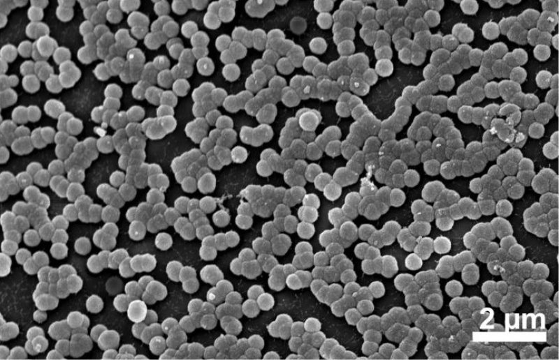 Photos from a scanning electron microscope show the brush-like array of light-absorbing structures on the leg of a midwater crustacean called Cystisom.
(c) Laura Bagge, Duke University