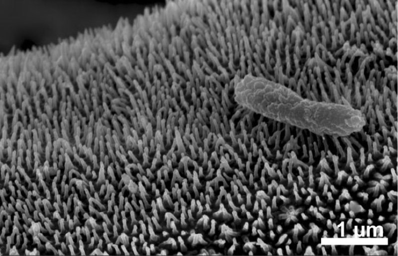 The tiny spheres that perform the same function on the body of Phronima, another midwater crustacean. The spheres may be a colony of bacteria specific to Phronima.
(c) Laura Bagge, Duke University