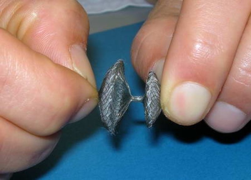 Umbrella for closing a PFO