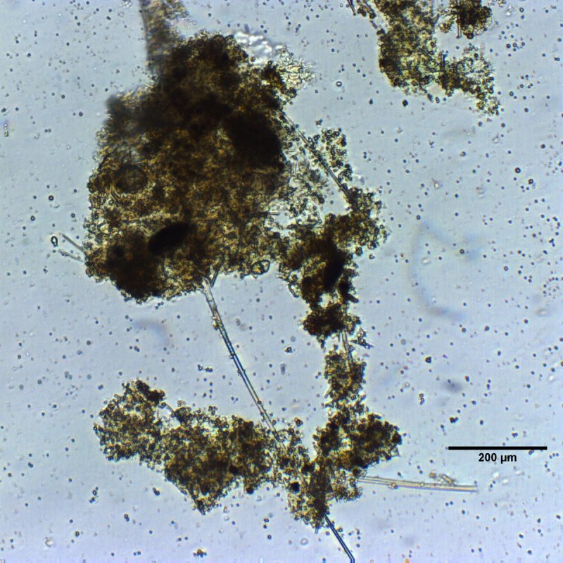 Microscopic image of marine snow
(c) Morten Iversen / AWI