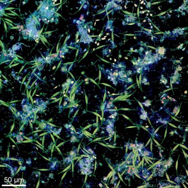 Biofilm formed by bacteria and microalgae on a plastic surface in water from the Kiel Fjord. The image was taken using confocal laser scanning microscopy, photo: © Jan Michels / Future Ocean