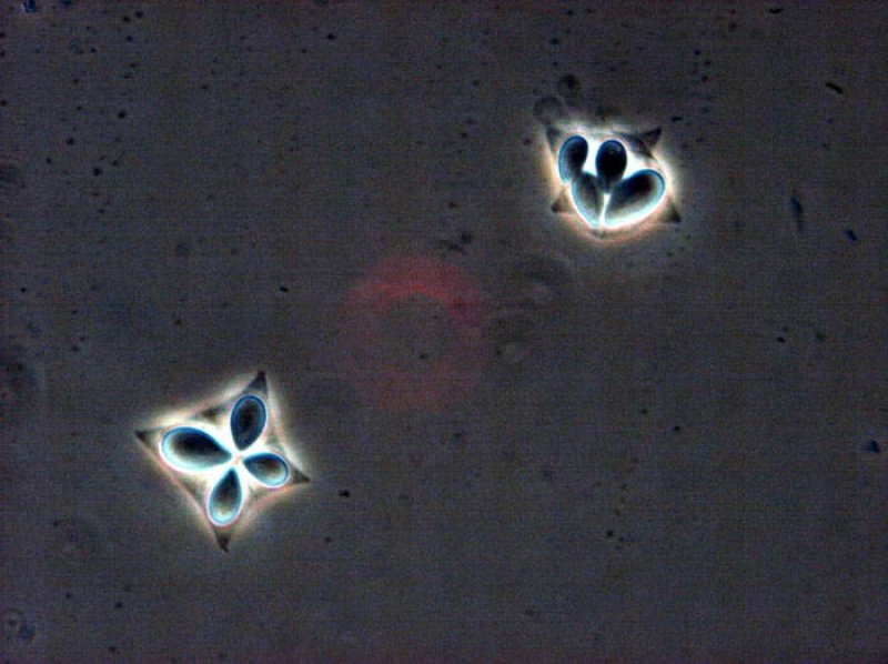 Two Kudoa spores as seen in thousandfold magnification, © Arne Levsen / Institute of Marine Research